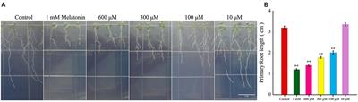 Melatonin Regulates Root Meristem by Repressing Auxin Synthesis and Polar Auxin Transport in Arabidopsis